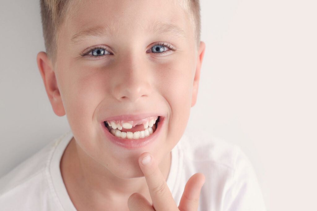 A young boy that is missing one of his front teeth